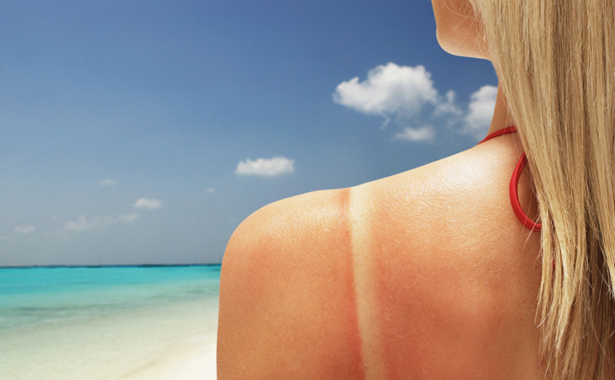 Holiday health problems in Spain and how to treat them